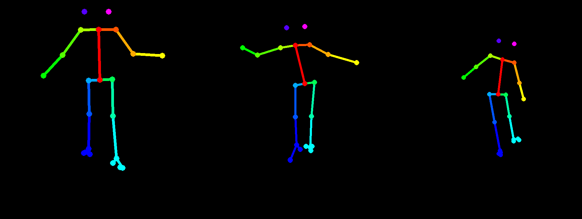 Dystonia De-Identified